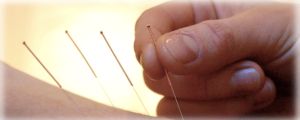 acupunctureneedles