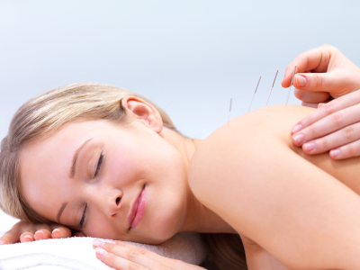 acupuncture menopause